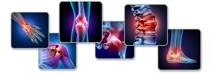 A collage of medical graphics highlighting joint and spine conditions, including wrist, knee, shoulder, hip, spine, and ankle, with red areas indicating pain or inflammation.